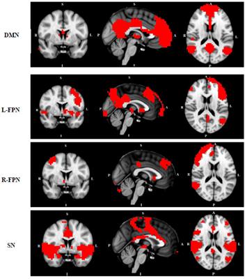 Altered Functional Connectivity in Resting State Networks in Tourette’s Disorder